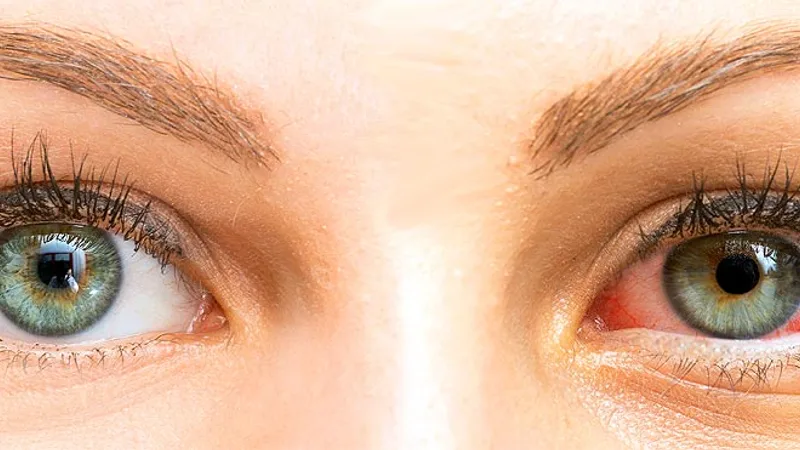 Augenärztin untersucht Patientin an der Spaltlampe – Diagnostik trockener Augen in der Augenarztpraxis Ludwigshafen