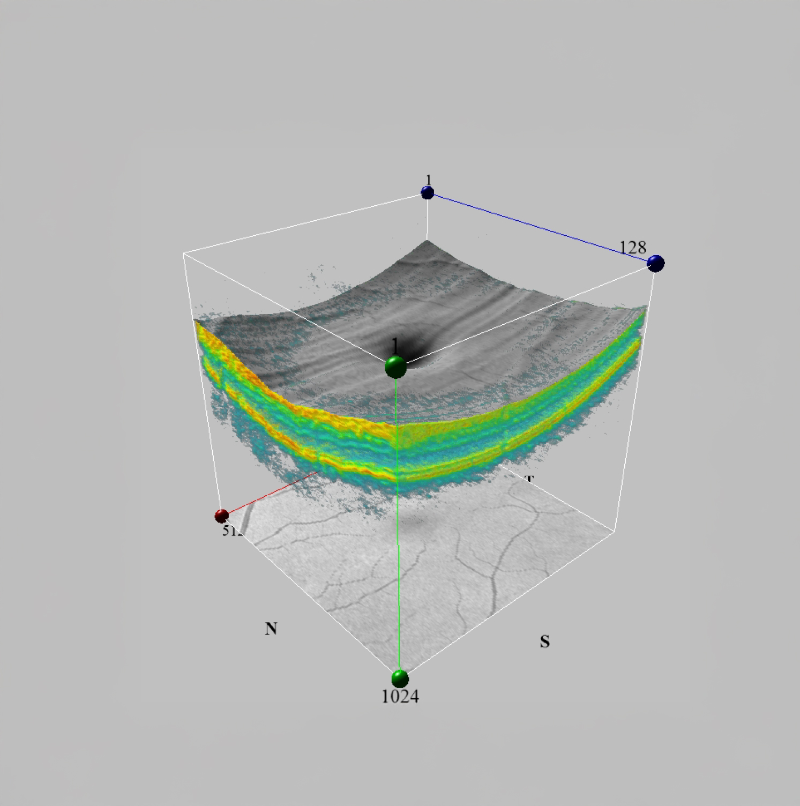 SD-OCT Diagnostic Device